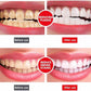 Yayashi SP-4 Ultra Whitening Toothpaste + FREE Nano Soft Toothbrush