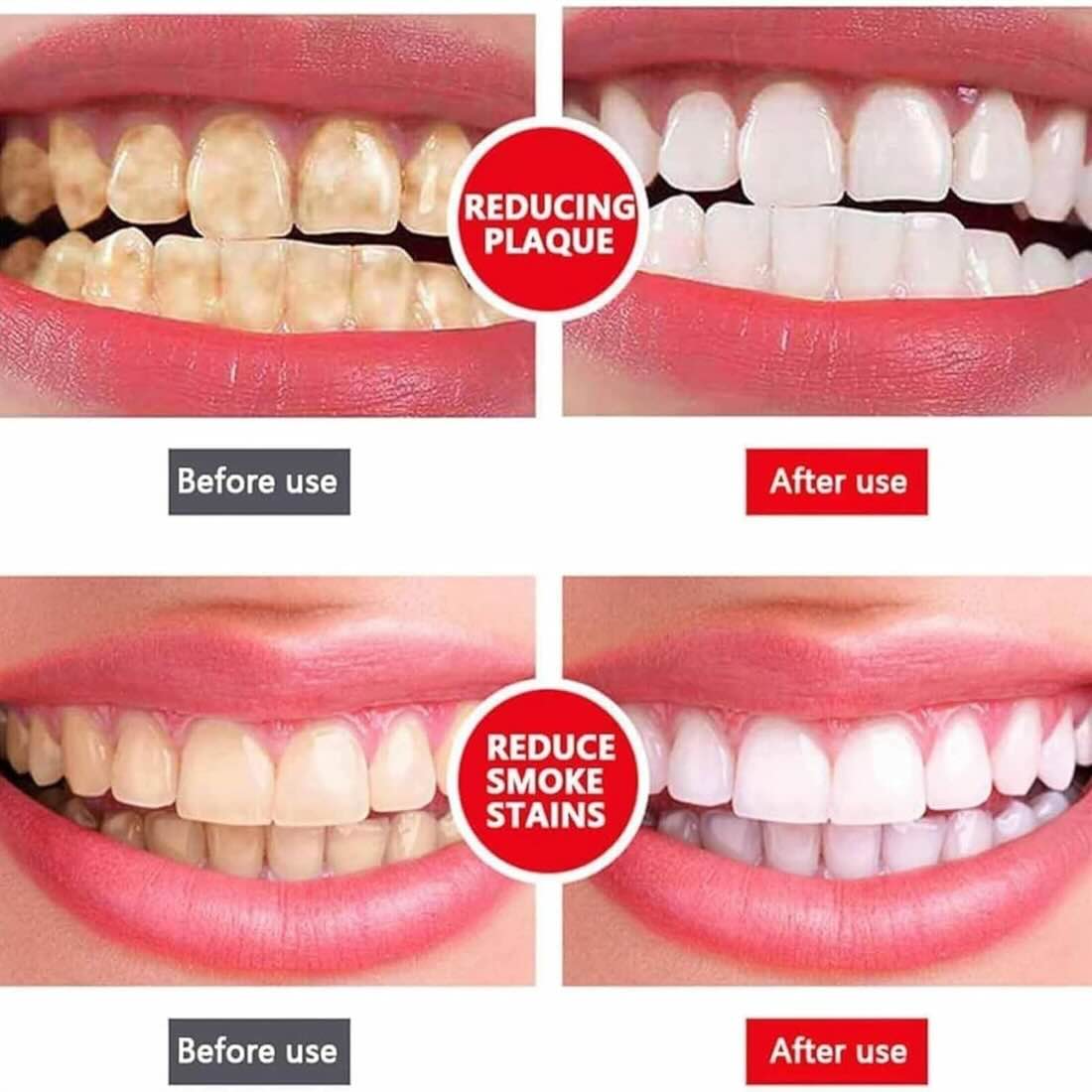 Yayashi SP-4 Ultra Whitening Toothpaste + FREE Nano Soft Toothbrush