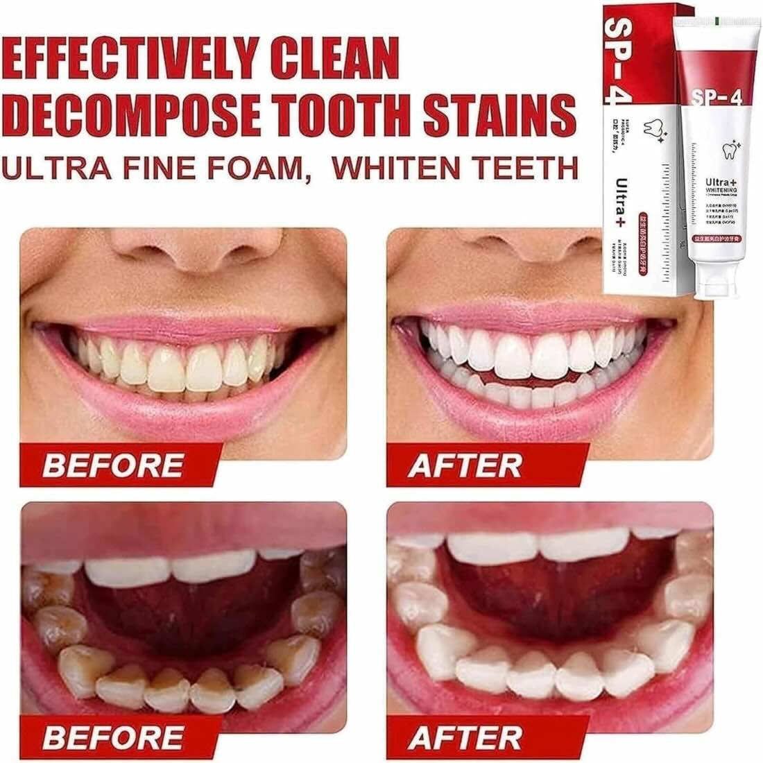 Yayashi SP-4 Ultra Whitening Toothpaste + FREE Nano Soft Toothbrush